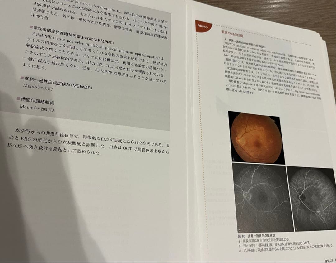 眼科ケーススタディ 網膜硝子体(裁断済み)